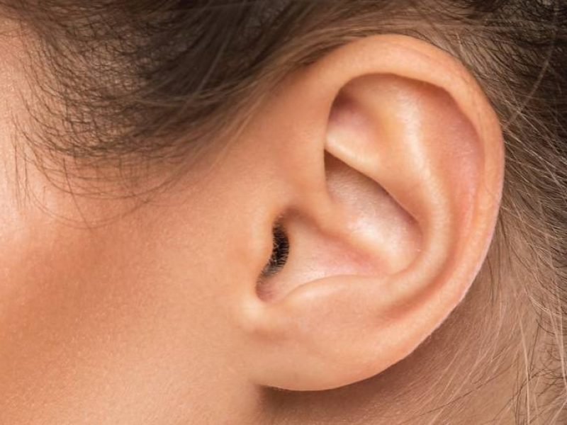 Cirurgia Plástica das Orelhas (Otoplastia)