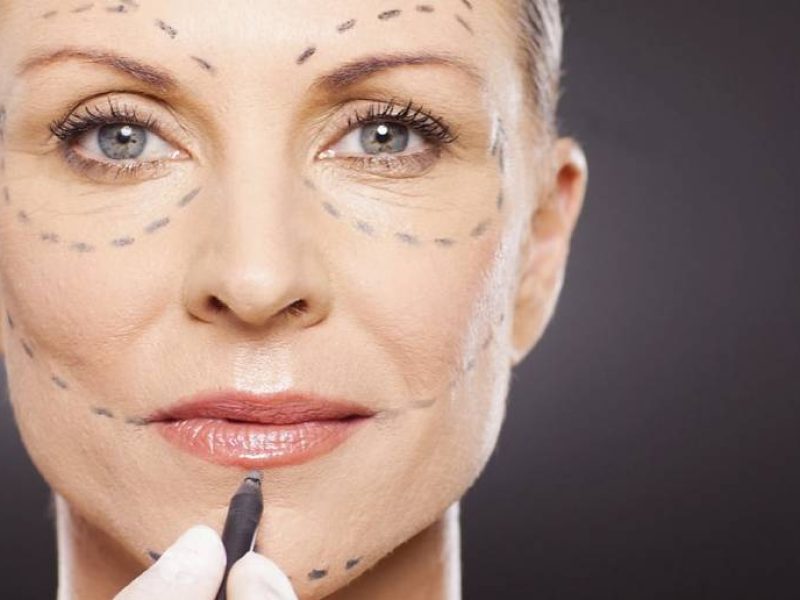 Lipoenxertia (Enxetia gordurosa da face, glúteos e deformidades de contorno corporal)