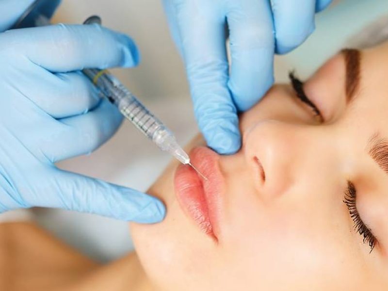 Preenchimento Facial com Ácido Hialurônico - Harmonização facial - MDCODES®